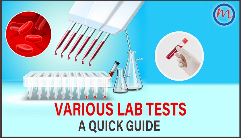 Various Lab Tests: A quick guide