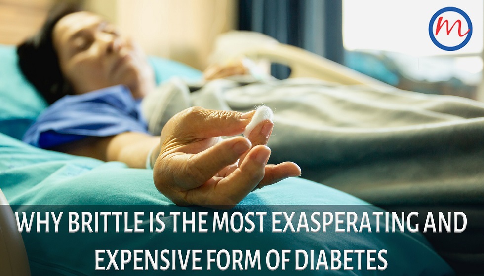 Why Brittle Is the Most Exasperating and Expensive Form of Diabetes
