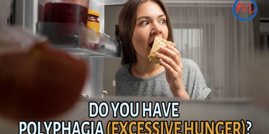 Do You Have Polyphagia (Excessive Hunger)?