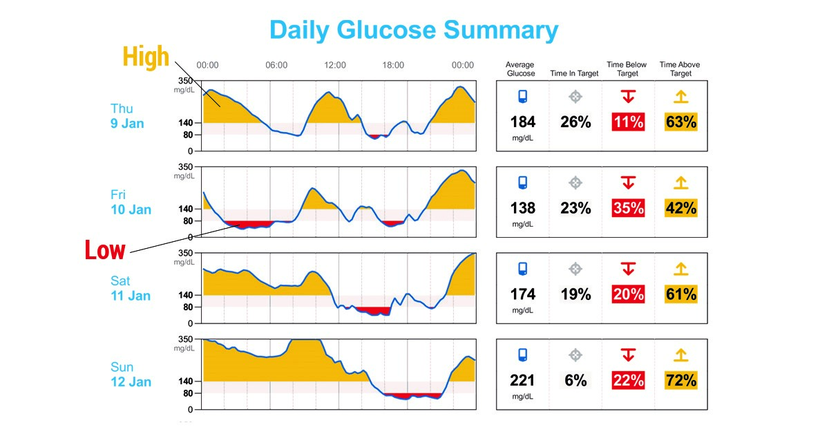  CGM Graph Report showing Time in Range, Time above Target