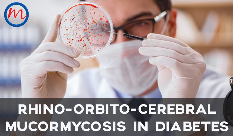 Rhino-orbito-cerebral Mucormycosis in Diabetes